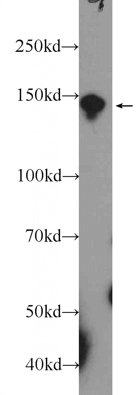 HeLa cells were subjected to SDS PAGE followed by western blot with Catalog No:114056(POM121 Antibody) at dilution of 1:300