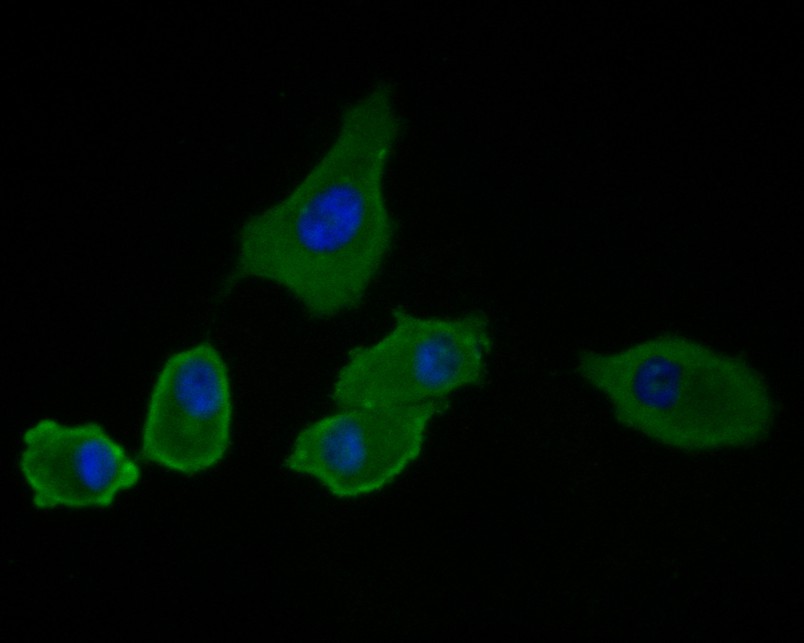 Fig2:; ICC staining of IL-7 in PANC-1 cells (green). Formalin fixed cells were permeabilized with 0.1% Triton X-100 in TBS for 10 minutes at room temperature and blocked with 10% negative goat serum for 15 minutes at room temperature. Cells were probed with the primary antibody ( 1/50) for 1 hour at room temperature, washed with PBS. Alexa Fluor®488 conjugate-Goat anti-Rabbit IgG was used as the secondary antibody at 1/1,000 dilution. The nuclear counter stain is DAPI (blue).