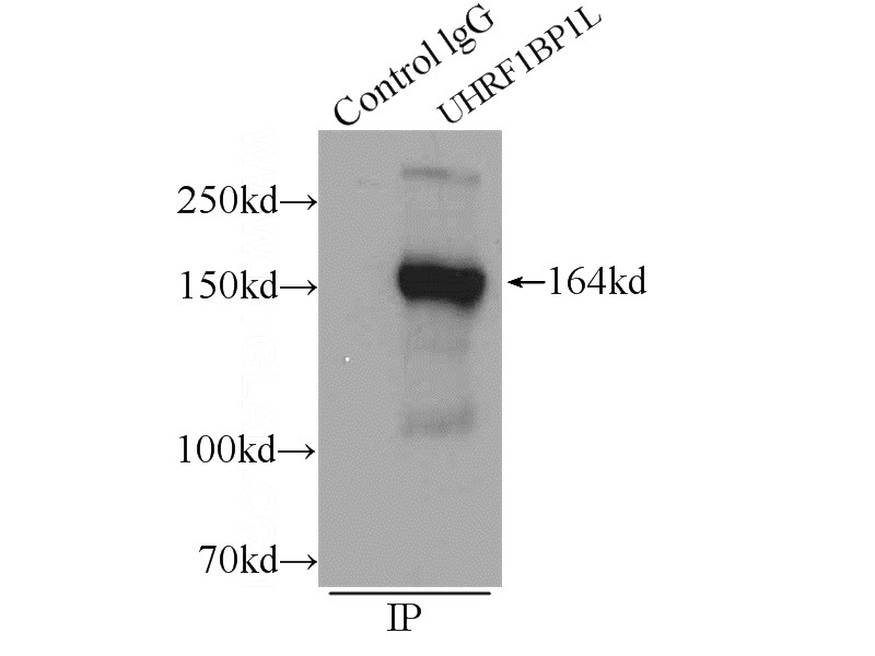 IP Result of anti-UHRF1BP1L (IP:Catalog No:116564, 5ug; Detection:Catalog No:116564 1:1000) with mouse brain tissue lysate 5000ug.