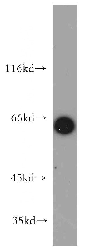 mouse heart tissue were subjected to SDS PAGE followed by western blot with Catalog No:110706(FOXO4 antibody) at dilution of 1:500