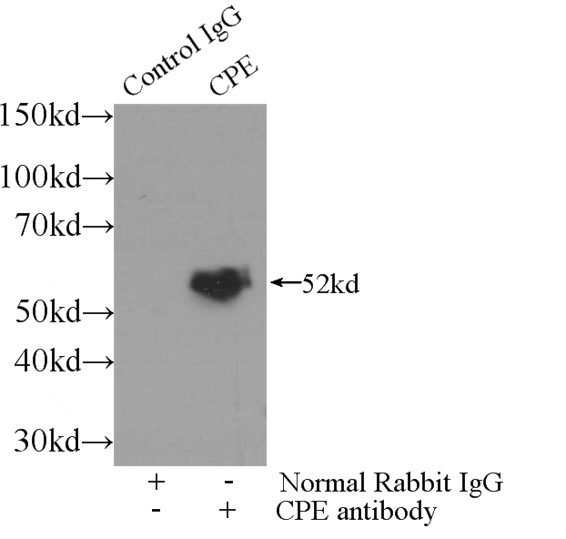 IP Result of anti-CPE (IP:Catalog No:108852, 3ug; Detection:Catalog No:108852 1:500) with mouse brain tissue lysate 3500ug.