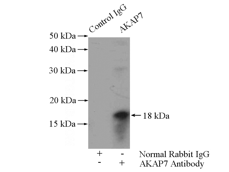 IP Result of anti-AKAP7 (IP:Catalog No:107934, 4ug; Detection:Catalog No:107934 1:300) with mouse brain tissue lysate 4000ug.
