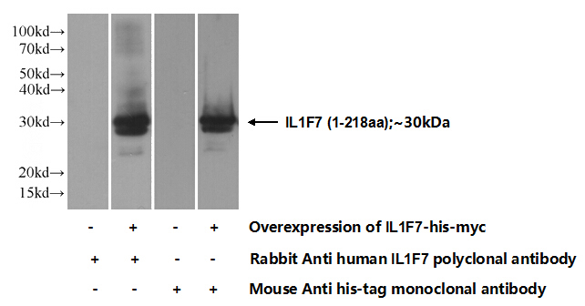 Transfected HEK-293 cells were subjected to SDS PAGE followed by western blot with Catalog No:111743(IL1F7 Antibody) at dilution of 1:500