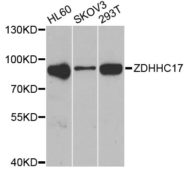 Western blot - ZDHHC17 Polyclonal Antibody 