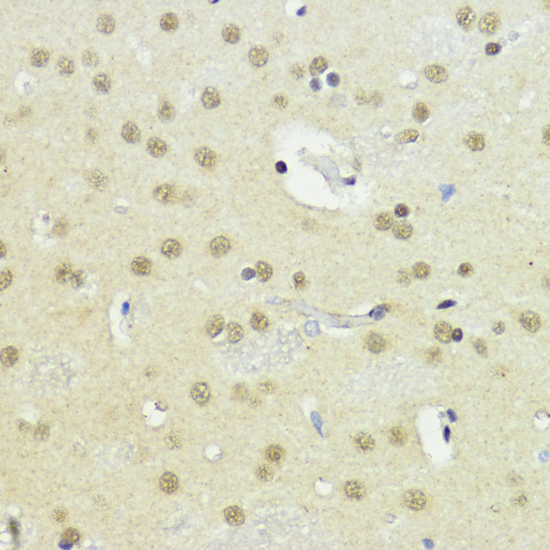 Immunohistochemistry - CTCF Polyclonal Antibody 