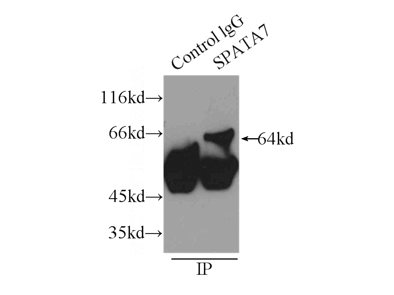 IP Result of anti-SPATA7 (IP:Catalog No:115555, 3ug; Detection:Catalog No:115555 1:300) with mouse testis tissue lysate 8000ug.