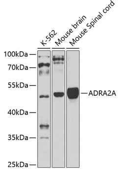 Western blot - ADRA2A Polyclonal Antibody 