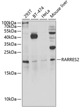 Western blot - RARRES2 Polyclonal Antibody 
