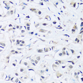 Immunohistochemistry - ARL6IP4 Polyclonal Antibody 