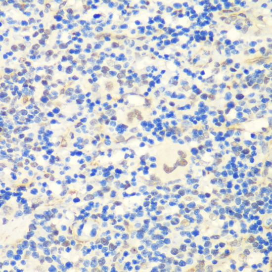 Immunohistochemistry - CTCF Polyclonal Antibody 