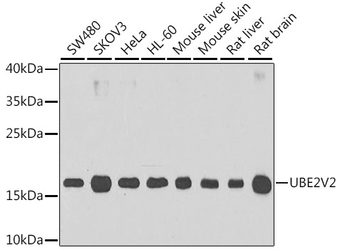 Western blot - UBE2V2 Polyclonal Antibody 