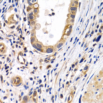 Immunohistochemistry - PTGIR Polyclonal Antibody 