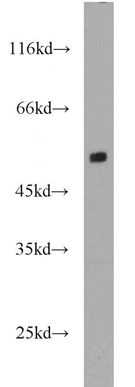 mouse brain tissue were subjected to SDS PAGE followed by western blot with Catalog No:109984(DKK3 antibody) at dilution of 1:500