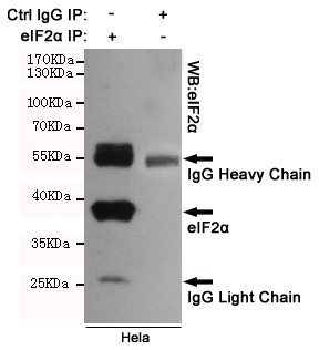 Immunoprecipitation analysis of Hela cell lysates using eIF2α.