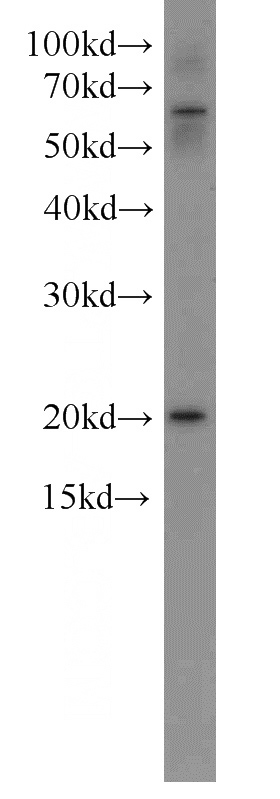 Jurkat cells were subjected to SDS PAGE followed by western blot with Catalog No:113271(NRAS antibody) at dilution of 1:500