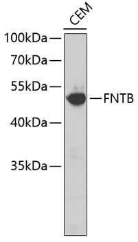 Western blot - FNTB Polyclonal Antibody 