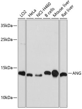 Western blot - ANG Polyclonal Antibody 