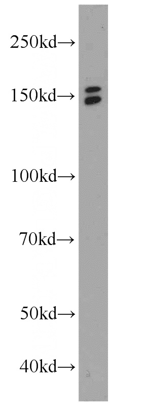 PC-3 cells were subjected to SDS PAGE followed by western blot with Catalog No:110307(C10orf137 antibody) at dilution of 1:1000