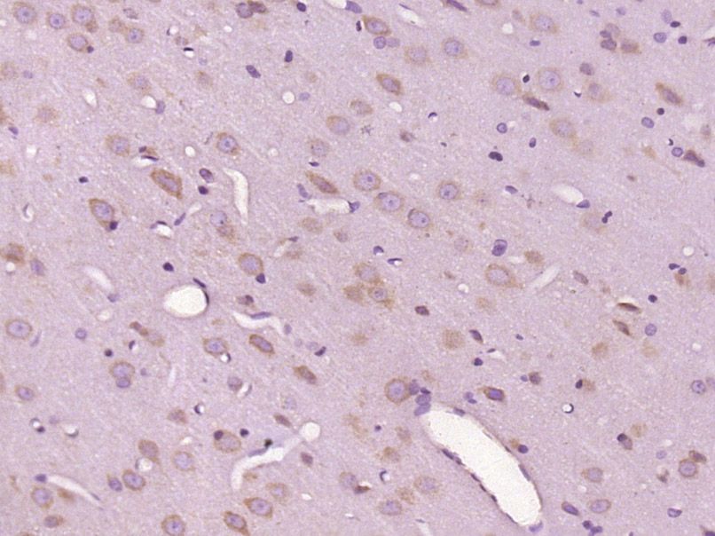 Fig1: Paraformaldehyde-fixed, paraffin embedded (Rat brain); Antigen retrieval by boiling in sodium citrate buffer (pH6.0) for 15min; Block endogenous peroxidase by 3% hydrogen peroxide for 20 minutes; Blocking buffer (normal goat serum) at 37℃ for 30min; Antibody incubation with (C12ORF50) Polyclonal Antibody, Unconjugated at 1:400 overnight at 4℃, followed by operating according to SP Kit(Rabbit) (sp-0023) instructionsand DAB staining.