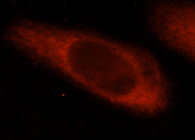 Immunofluorescent analysis of Hela cells, using CEACAM21 antibody Catalog No:109243 at 1:25 dilution and Rhodamine-labeled goat anti-rabbit IgG (red).