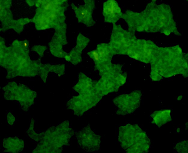 Fig1: ICC staining ERAS in NCCIT cells (green). Formalin fixed cells were permeabilized with 0.1% Triton X-100 in TBS for 10 minutes at room temperature and blocked with 1% Blocker BSA for 15 minutes at room temperature. Cells were probed with ERAS monoclonal antibody at a dilution of 1:200 for 1 hour at room temperature, washed with PBS. Alexa Fluorc™ 488 Goat anti-Mouse IgG was used as the secondary antibody at 1/100 dilution.