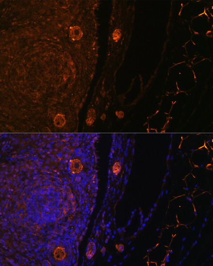 Immunofluorescence - ZP3 Polyclonal Antibody 