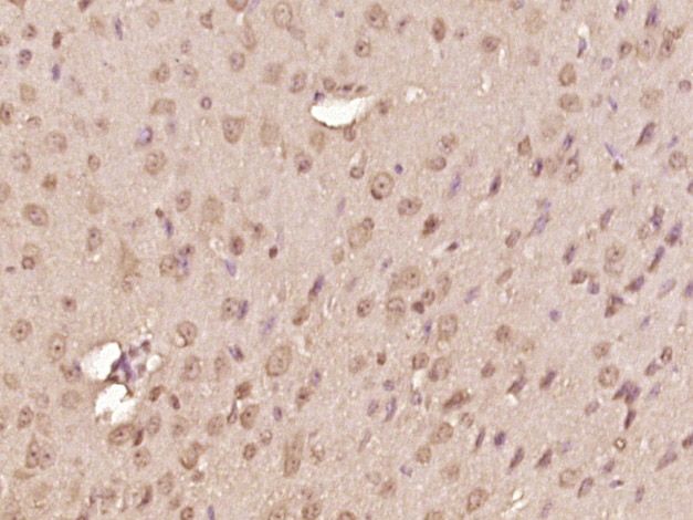 Fig2: Paraformaldehyde-fixed, paraffin embedded (mouse brain tissue); Antigen retrieval by boiling in sodium citrate buffer (pH6.0) for 15min; Block endogenous peroxidase by 3% hydrogen peroxide for 20 minutes; Blocking buffer (normal goat serum) at 37℃ for 30min; Antibody incubation with (RNF39) Polyclonal Antibody, Unconjugated at 1:400 overnight at 4℃, followed by operating according to SP Kit(Rabbit) (sp-0023) instructionsand DAB staining.