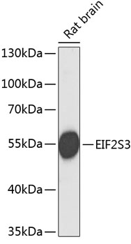 Western blot - EIF2S3 Polyclonal Antibody 