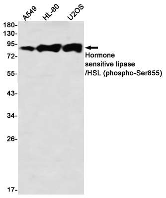 Western blot detection of Hormone sensitive lipase/HSL (phospho-Ser855) in A549,HL-60,U2OS using Hormone sensitive lipase/HSL (phospho-Ser855) Rabbit mAb(1:1000 diluted)