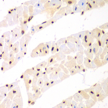 Immunohistochemistry - NONO Polyclonal Antibody 