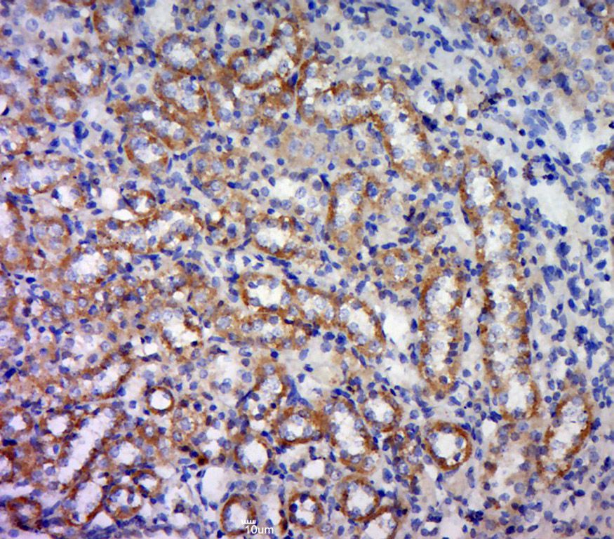 Fig3: Paraformaldehyde-fixed, paraffin embedded (Rat kidney); Antigen retrieval by boiling in sodium citrate buffer (pH6.0) for 15min; Block endogenous peroxidase by 3% hydrogen peroxide for 20 minutes; Blocking buffer (normal goat serum) at 37℃ for 30min; Antibody incubation with (FSD1L) Polyclonal Antibody, Unconjugated at 1:500 overnight at 4℃, followed by a conjugated secondary (sp-0023) for 20 minutes and DAB staining.