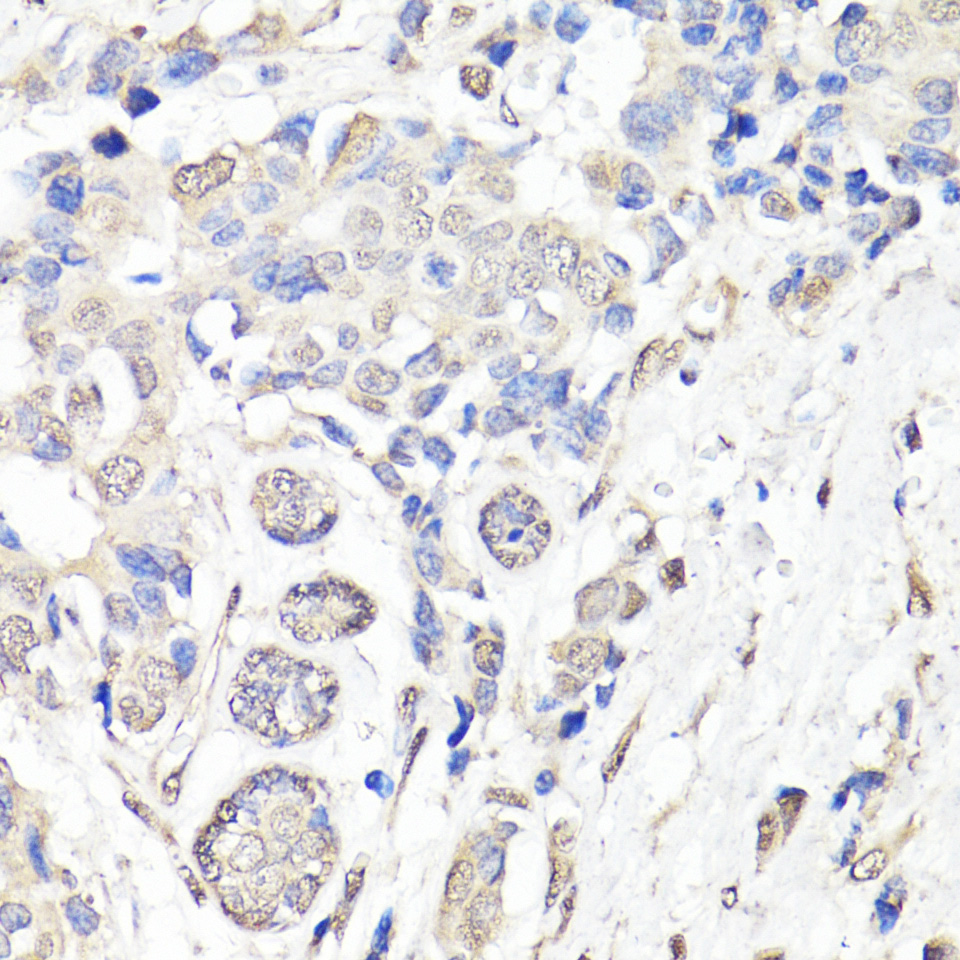 Immunohistochemistry - BAP1 Polyclonal Antibody 