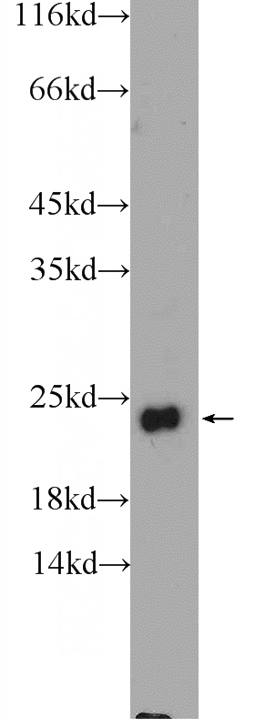 fetal human brain tissue were subjected to SDS PAGE followed by western blot with Catalog No:110625(FEV Antibody) at dilution of 1:1000