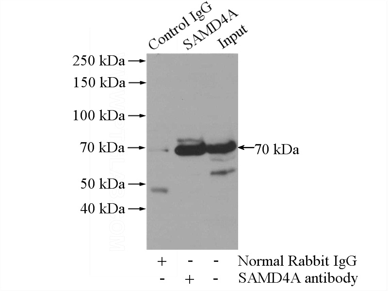 IP Result of anti-SAMD4A (IP:Catalog No:115052, 4ug; Detection:Catalog No:115052 1:500) with mouse skeletal muscle tissue lysate 2200ug.