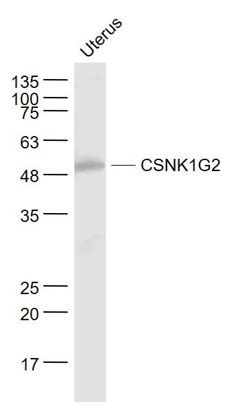 Fig1: Sample:; Uterus (Mouse) Lysate at 40 ug; Primary: Anti- CSNK1G2 at 1/1000 dilution; Secondary: IRDye800CW Goat Anti-Rabbit IgG at 1/20000 dilution; Predicted band size: 47 kD; Observed band size: 49 kD