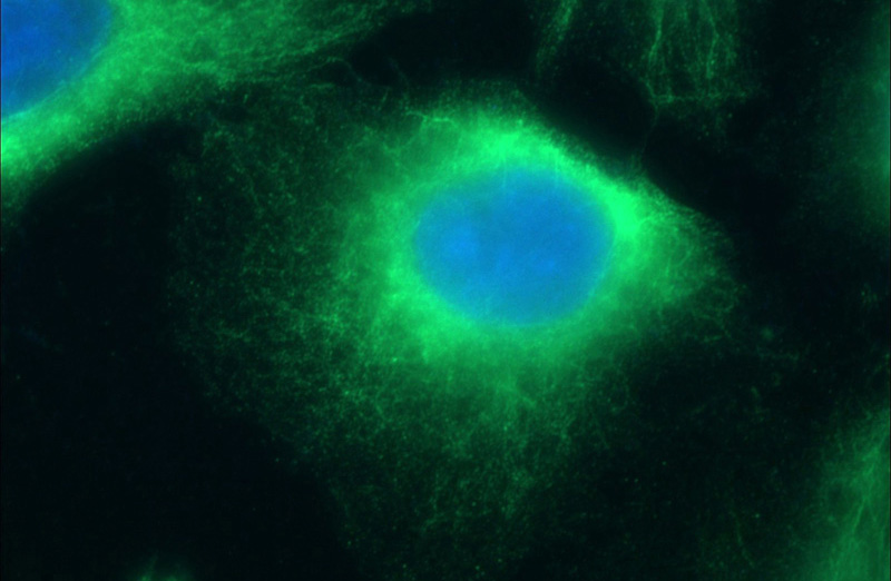 Immunofluorescent analysis of (-20oc Ethanol) fixed HUVEC cells using Catalog No:109394(CLIP4 Antibody) at dilution of 1:25 and Alexa Fluor 488-congugated AffiniPure Goat Anti-Rabbit IgG(H+L)