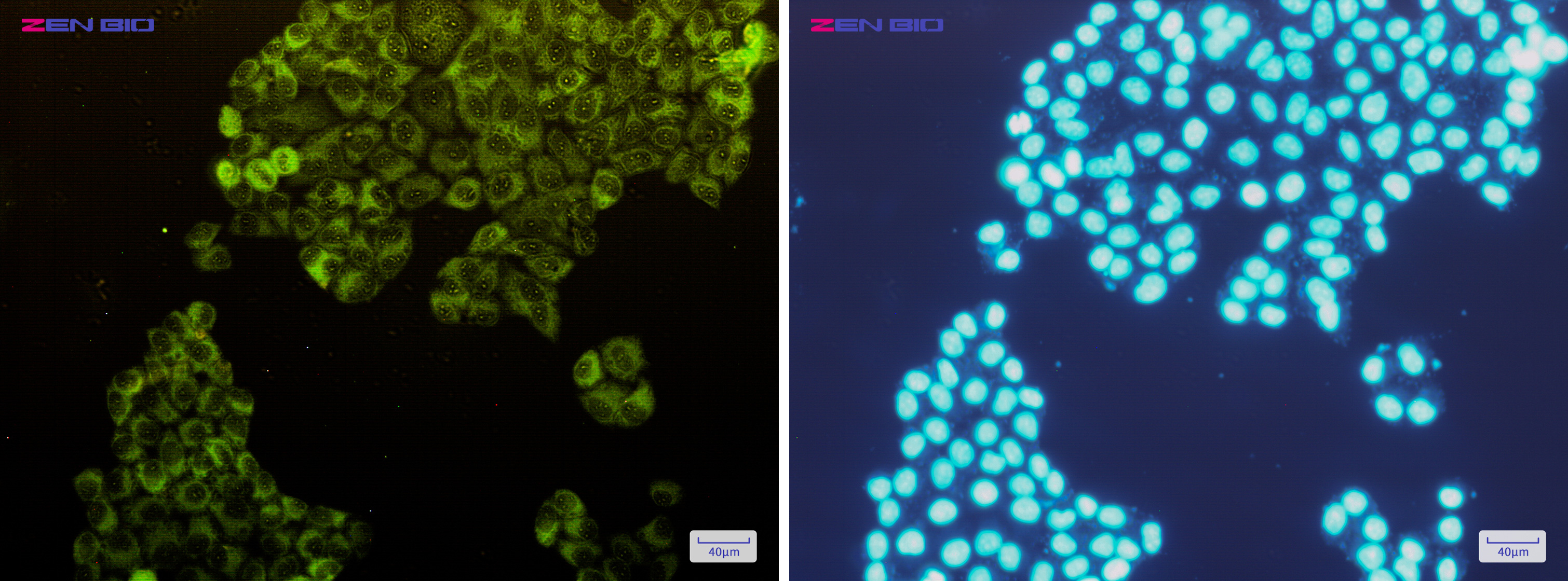 Immunocytochemistry of Fructose 6 Phosphate Kinase(green) in Hela cells using Fructose 6 Phosphate Kinase Rabbit mAb at dilution 1/200, and DAPI(blue)