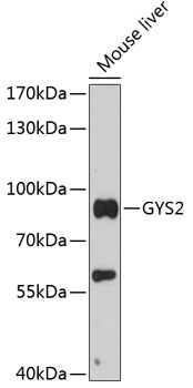 Western blot - GYS2 Polyclonal Antibody 