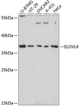 Western blot - ELOVL4 Polyclonal Antibody 