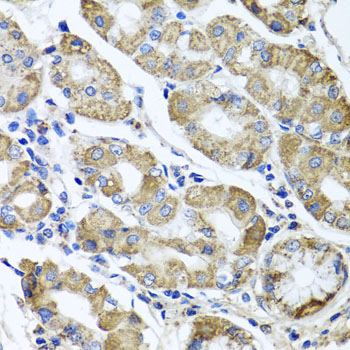 Immunohistochemistry - ETFA Polyclonal Antibody 