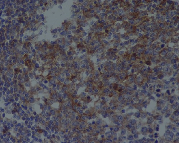Immunohistochemical analysis of paraffin-embedded human tonsil, using CD81 Antibody.
