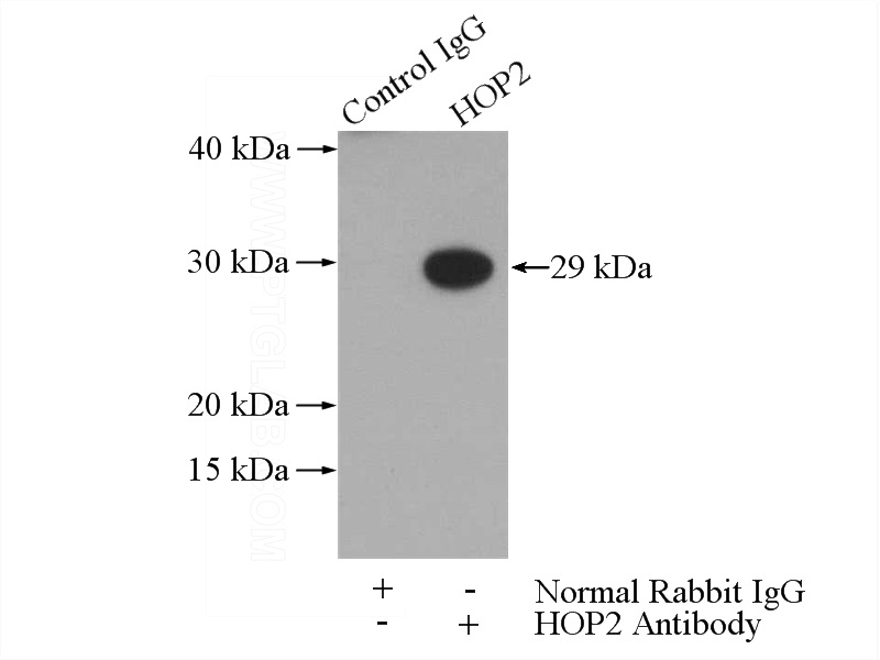 IP Result of anti-PSMC3IP (IP:Catalog No:111523, 4ug; Detection:Catalog No:111523 1:500) with Jurkat cells lysate 3200ug.
