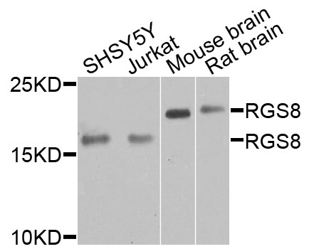 Western blot - RGS8 Polyclonal Antibody 