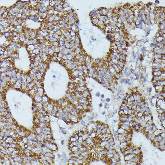 Immunohistochemistry - FLII Polyclonal Antibody 