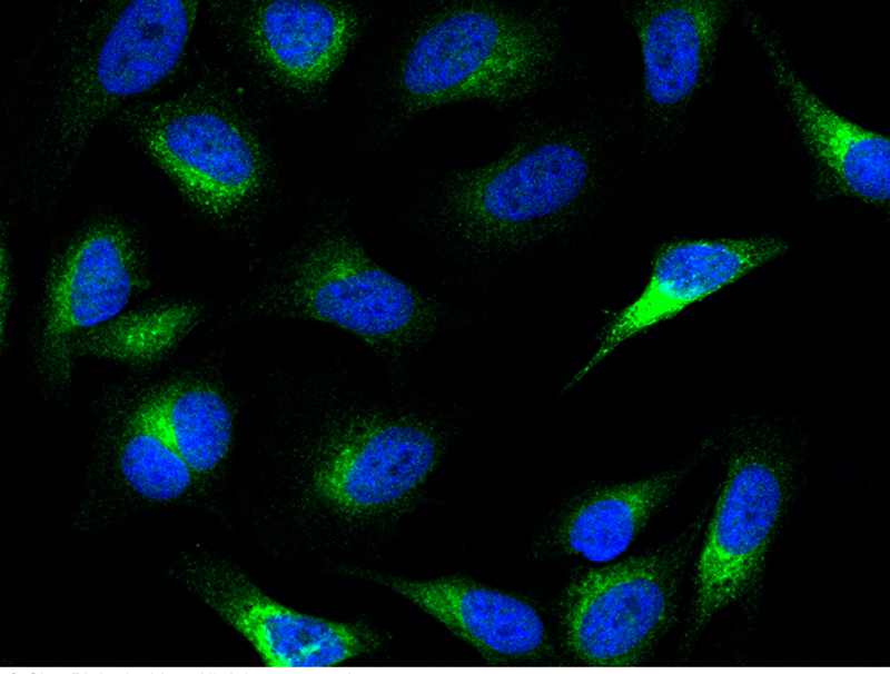 Mouse PCSK9/NARC1 Immunofluorescence(IF) 15963