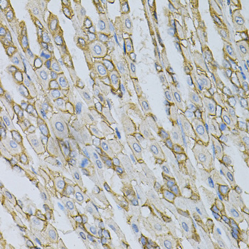 Immunohistochemistry - AP2B1 Polyclonal Antibody 