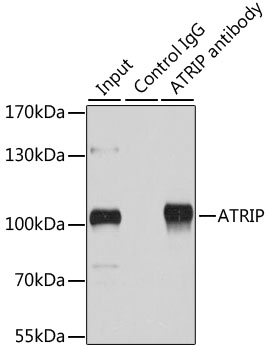 Immunoprecipitation - ATRIP Polyclonal Antibody 