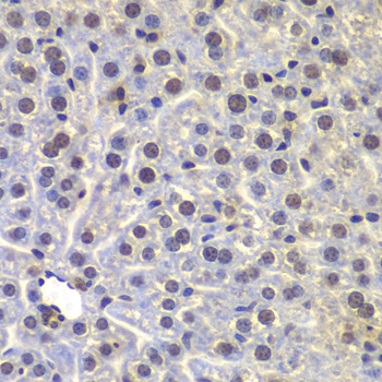 Immunohistochemistry - FUBP3 Polyclonal Antibody 