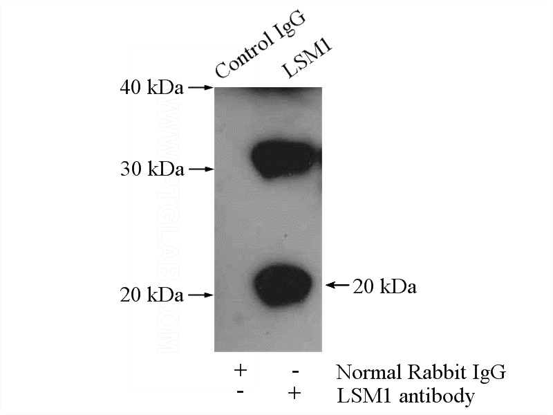 IP Result of anti-LSM1 (IP:Catalog No:112345, 4ug; Detection:Catalog No:112345 1:300) with HeLa cells lysate 2000ug.