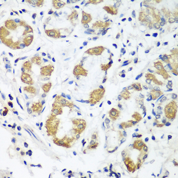 Immunohistochemistry - OXCT1 Polyclonal Antibody 